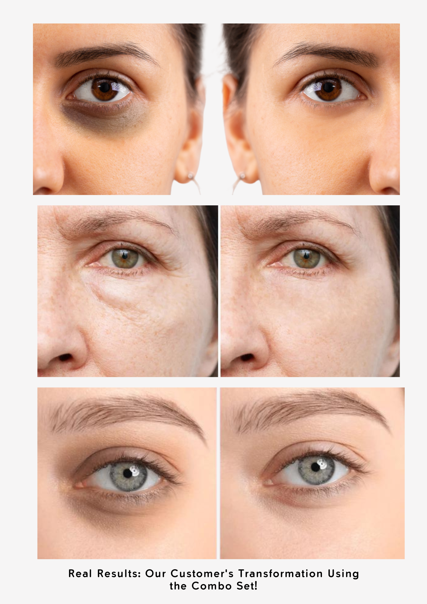Combo Set for Dark Circles, Puffiness and Dull Eyes